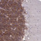 Anti-GPRIN3 Antibody
