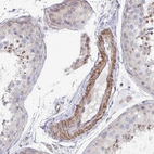 Immunohistochemical staining of human testis shows weak to moderate cytoplasmic positivity in smooth muscle cells.
