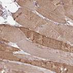 Immunohistochemical staining of human skeletal muscle shows moderate to strong cytoplasmic positivity in myocytes.