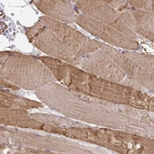 Immunohistochemical staining of human skeletal muscle shows moderate to strong cytoplasmic positivity in myocytes.