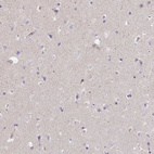 Immunohistochemical staining of human cerebral cortex shows no positivity in neurons.