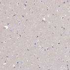 Immunohistochemical staining of human cerebral cortex shows no positivity in neurons.