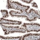 Immunohistochemical staining of human fallopian tube shows strong nuclear positivity in glandular cells.