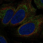 Anti-P2RX1 Antibody