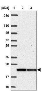 Lane 1: Marker [kDa] 250, 130, 95, 72, 55, 36, 28, 17, 10_br/_Lane 2: Human cell line RT-4_br/_Lane 3: Human cell line U-251MG sp