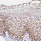 Anti-ADRA2C Antibody