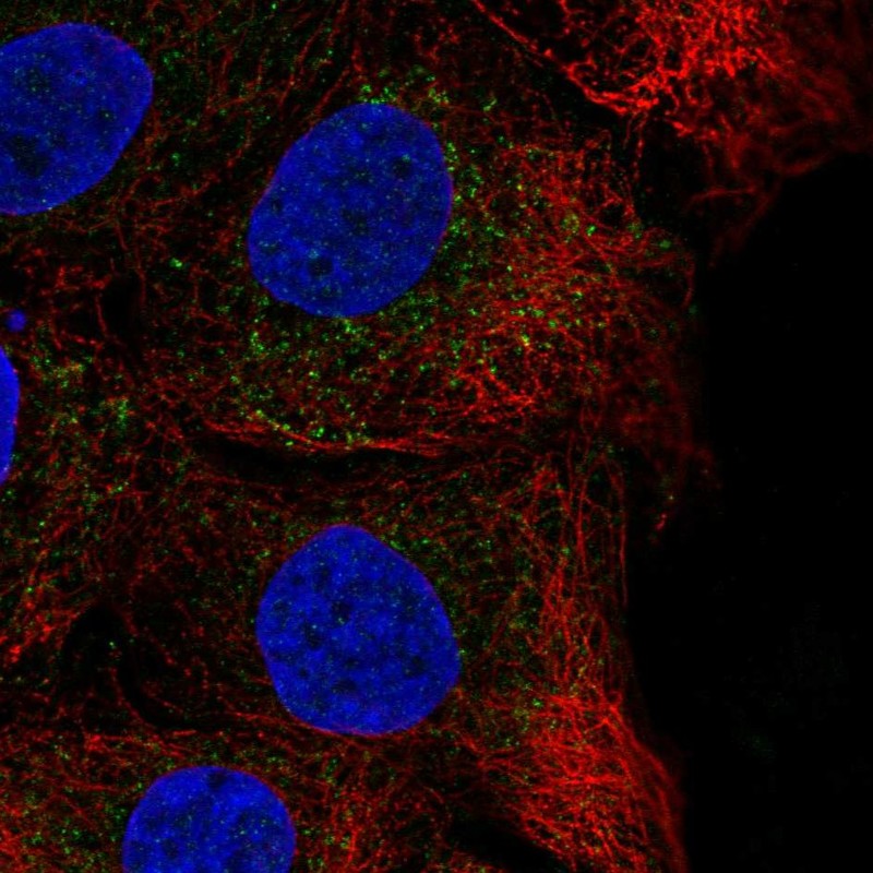Anti-CHST14 Antibody