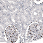 Anti-WT1 Antibody