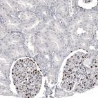 Immunohistochemical staining of human kidney shows strong nuclear positivity in cells in glomeruli.
