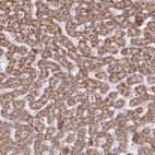 Anti-ACSM2A Antibody