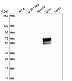 Western blot analysis in human cell line RT-4, human cell line U-251 MG, human plasma, human liver tissue and human tonsil tissue.