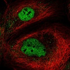 Anti-NEMP2 Antibody