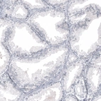 Immunohistochemical staining of human prostate shows no positivity in glandular cells as expected.