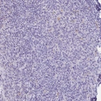 Immunohistochemical staining of human tonsil shows weak cytoplasmic and secreted positivity in non-germinal center cells.