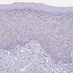 Anti-XCL1 Antibody