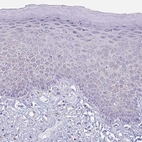 Immunohistochemical staining of human skin shows no positivity in squamous epithelial cells as expected.