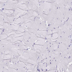 Anti-XCL1 Antibody