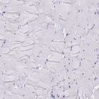 Immunohistochemical staining of human skeletal muscle shows no positivity in myocytes as expected.