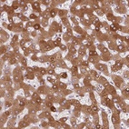 Anti-ORM1 Antibody