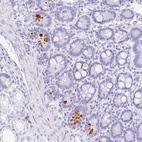 Anti-NDUFAF8 Antibody