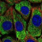 Immunofluorescent staining of human cell line MCF7 shows localization to cytosol.