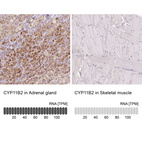 Anti-CYP11B2 Antibody