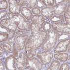 Anti-PLA2G12B Antibody