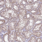 Immunohistochemical staining of human kidney shows weak cytoplasmic positivity in cells in tubules.