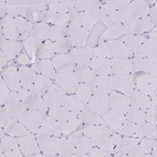 Anti-PLA2G12B Antibody