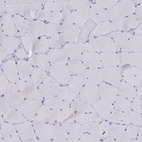 Immunohistochemical staining of human skeletal muscle shows no positivity in myocytes as expected.