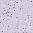 Immunohistochemical staining of human skeletal muscle shows no positivity in myocytes as expected.