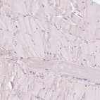 Immunohistochemical staining of human skeletal muscle shows no positivity in myocytes as expected.