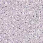 Immunohistochemical staining of human liver shows no positivity in hepatocytes as expected.