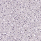 Immunohistochemical staining of human liver shows no positivity in hepatocytes as expected.