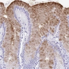 Immunohistochemical staining of human stomach shows strong cytoplasmic positivity in glandular cells.