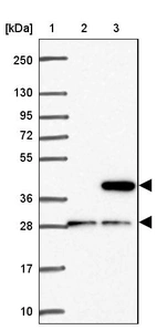 Lane 1: Marker [kDa] 250, 130, 95, 72, 55, 36, 28, 17, 10_br/_Lane 2: Human cell line RT-4_br/_Lane 3: Human cell line U-251MG sp