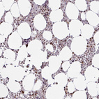 Anti-CLP1 Antibody