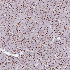 Immunohistochemical staining of human pancreas shows strong nuclear positivity in exocrine glandular cells.
