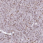 Anti-CLP1 Antibody