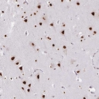 Immunohistochemical staining of human cerebral cortex shows strong nuclear positivity in neuronal cells.