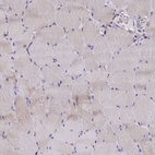 Immunohistochemical staining of human skeletal muscle shows weak cytoplasmic positivity in myocytes.