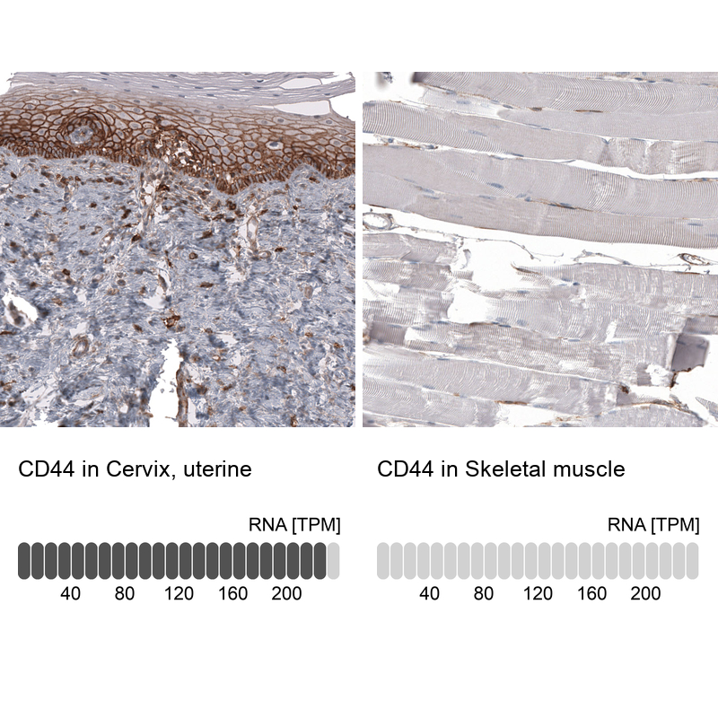Anti-CD44 Antibody