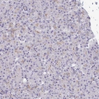 Immunohistochemical staining of human pancreas shows moderate membranous positivity in exocrine glandular cells.