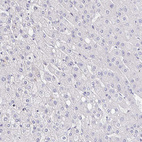 Immunohistochemical staining of human liver shows no positivity in hepatocytes.
