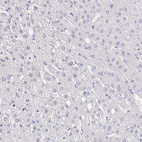 Anti-P2RX3 Antibody