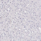 Immunohistochemical staining of human liver shows no positivity in hepatocytes.
