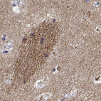 Anti-GNG7 Antibody