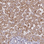 Anti-ZNF644 Antibody