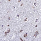Immunohistochemical staining of human cerebral cortex using Anti-RPS15 antibody HPA057793.