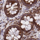 Immunohistochemical staining of human colon using Anti-RPS15 antibody HPA057793.